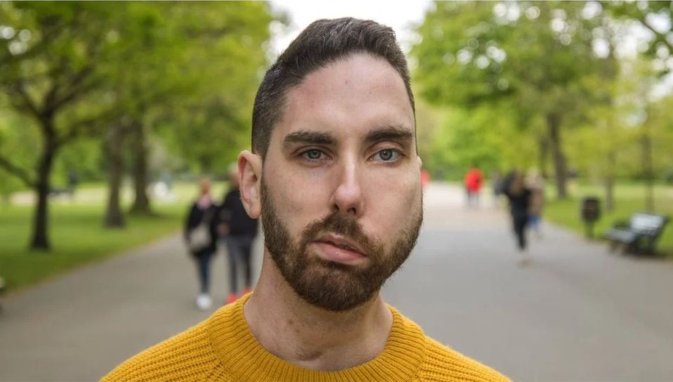 “Me he tenido que esconder de la gente que se quedaba mirándome en espacios públicos”