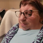 “Mis orejas prostéticas me hicieron sentir más normal”: vivir con síndrome de Treacher Collins, la extraña enfermedad que afecta el desarrollo facial