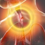 Cuáles son los síntomas del cáncer de esófago y por qué no debemos ignorarlos