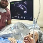 La extraordinaria operación con la que unos médicos quemaron el tumor de un bebé en el útero para salvarle la vida