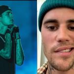 Justin Bieber: qué se sabe sobre la parálisis facial que sufrió el artista (y las razones de este peligroso padecimiento)