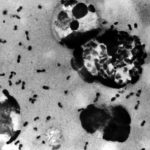 Dientes antiguos revelan por fin dónde se originó la peste negra, la más mortífera de la historia