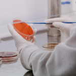 Viruela del mono: Epidemióloga habla sobre cómo pueden ser los síntomas y emiten recomendaciones de prevención