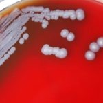 La peligrosa bacteria encontrada en EE.UU. que preocupa a las autoridades de salud del país