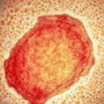 Viruela del mono: OMS recuerda que la vacuna tarda semanas en inmunizar