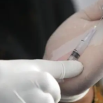 Viruela del mono: Verdades y mentiras acerca del virus, el contagio y cómo se puede prevenir