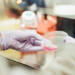 Ministerio de Salud confirma que Guatemala suma 15 casos de viruela del mono  desde que se detectó el primer contagio hace 49 días