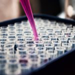 Detectan un nuevo caso de viruela del mono en Guatemala: Salud ha diagnosticado 20 pacientes