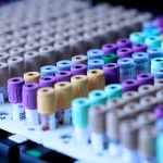Casos de viruela del mono siguen en aumento en Guatemala, donde se acumulan 43 contagios