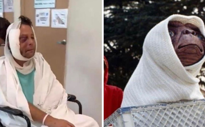 Alfredo Adame los mejores memes del actor luego de ser operado del ojo