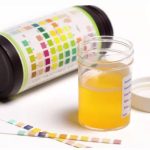 Cistitis, la dolorosa enfermedad que sufre cerca del 50% de las mujeres y que continúa siendo mal diagnosticada y mal tratada