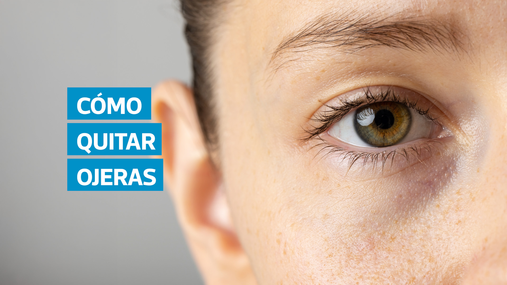 VIDEO | Ojeras: causas y consejos efectivos para eliminarlas, según dermatólogos