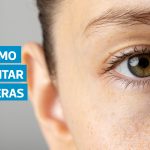 VIDEO | Ojeras: causas y consejos efectivos para eliminarlas, según dermatólogos